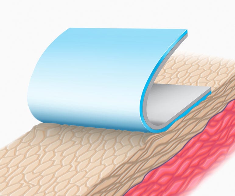 Friable tissue