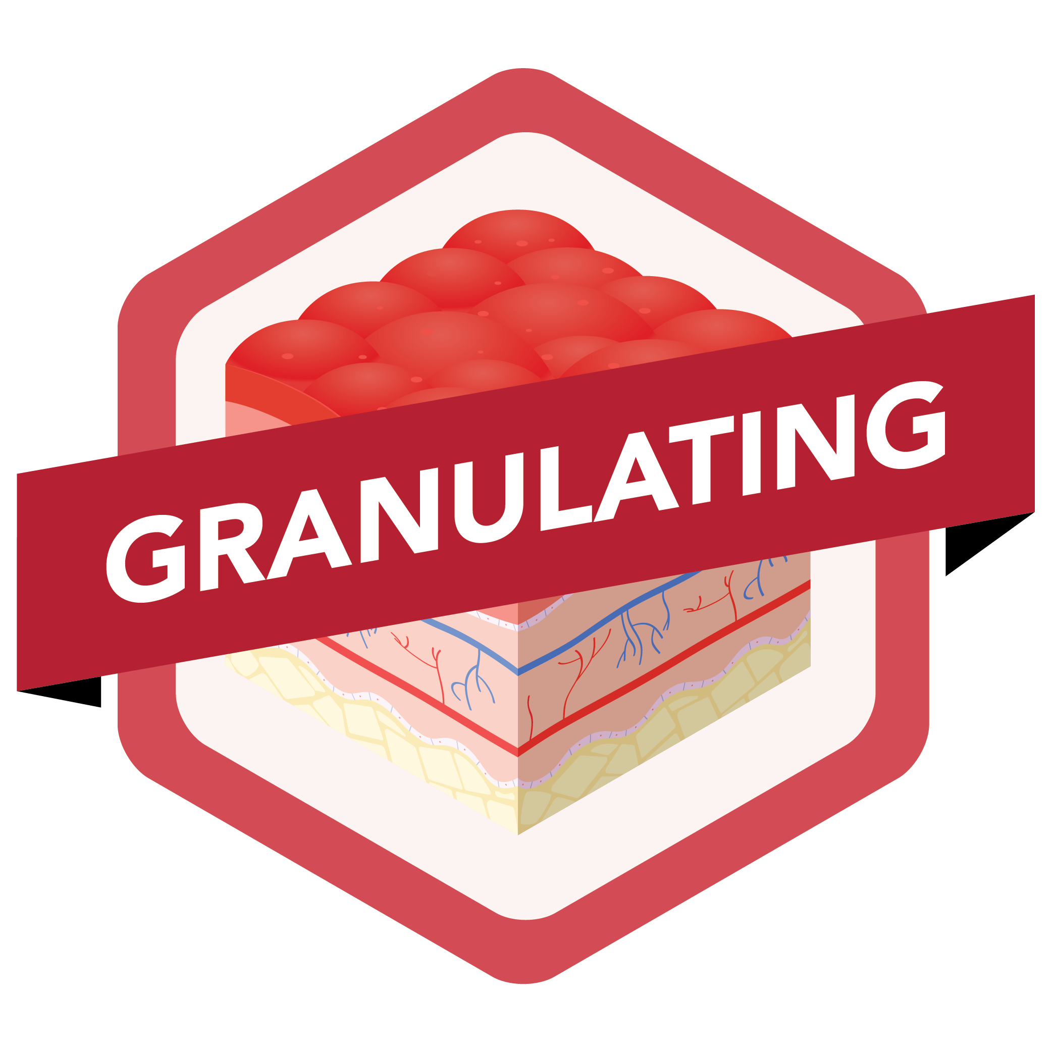 Granulating